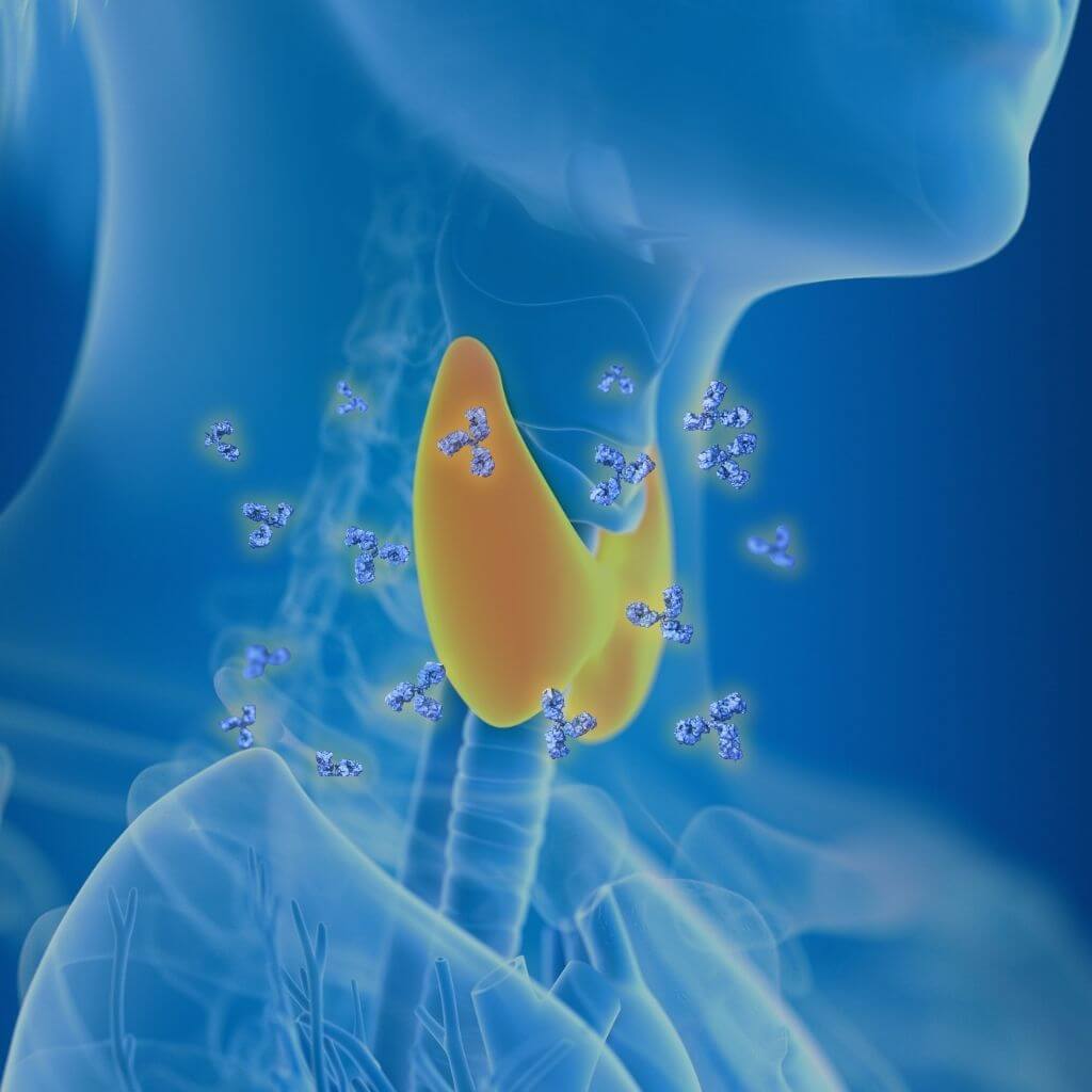 autoimmune disease